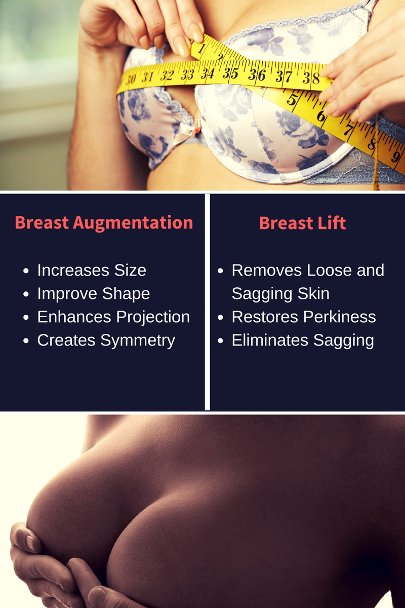 Will Breast Augmentation Help with Sagging