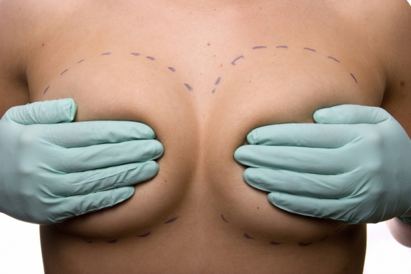 3 Tips to Prepare for Breast Augmentation Surgery & Recovery