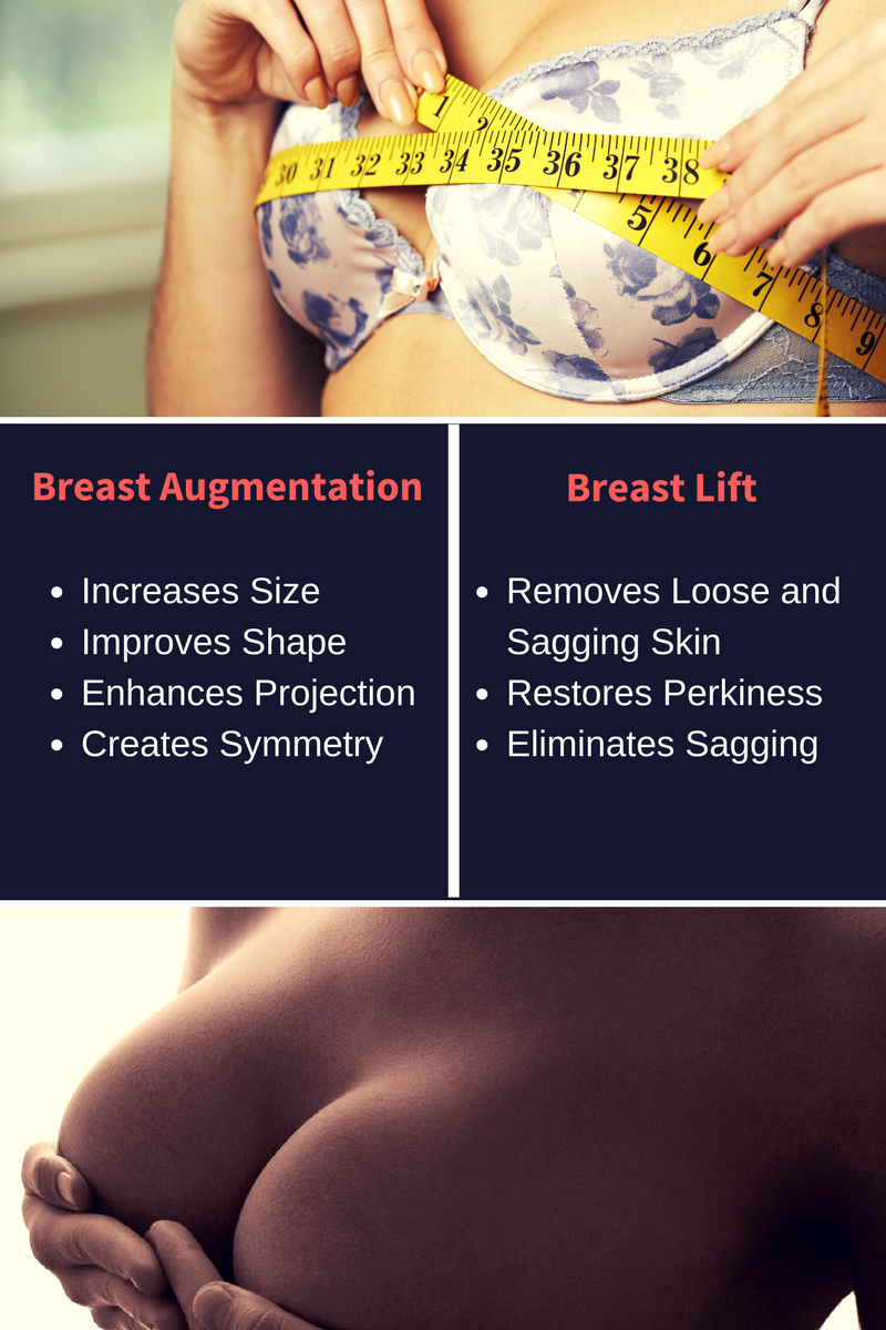 Are Breast Implants or A Breast Lift Best for Droopy Breasts?