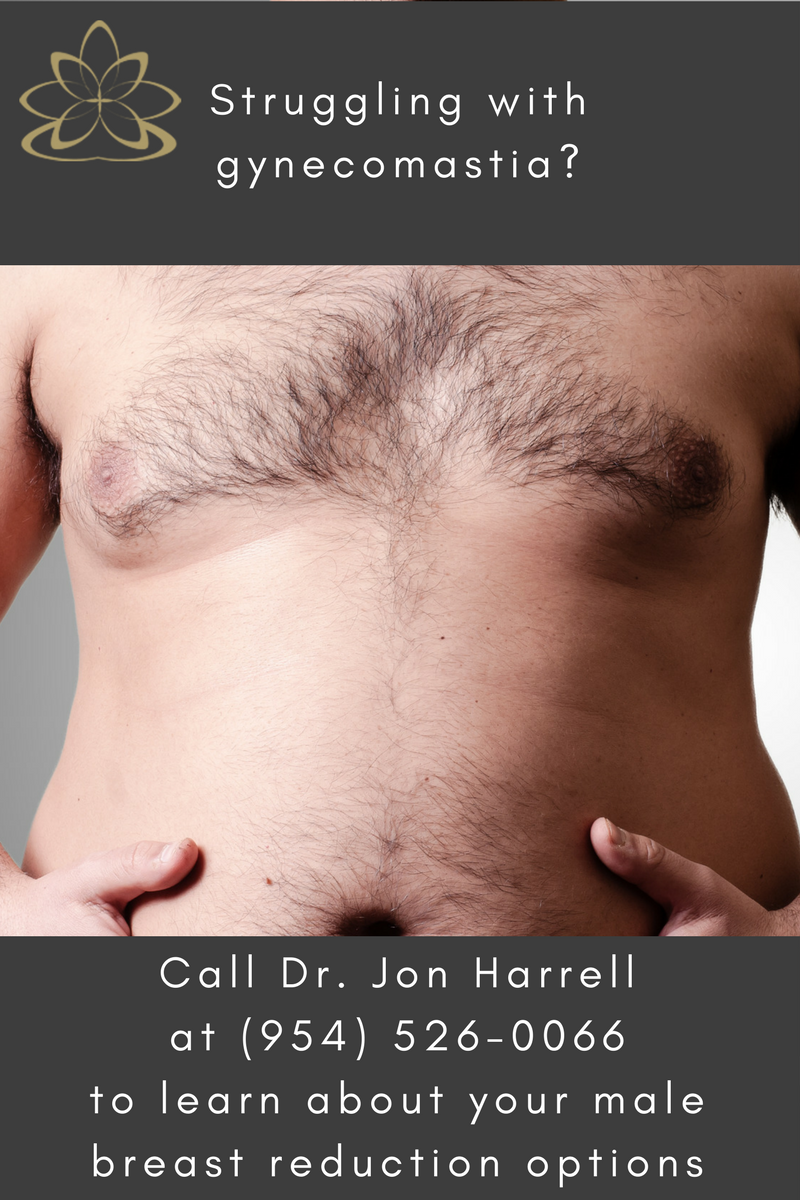 Male Breast Reduction Miami | Gynecomastia Ft. Lauderdale