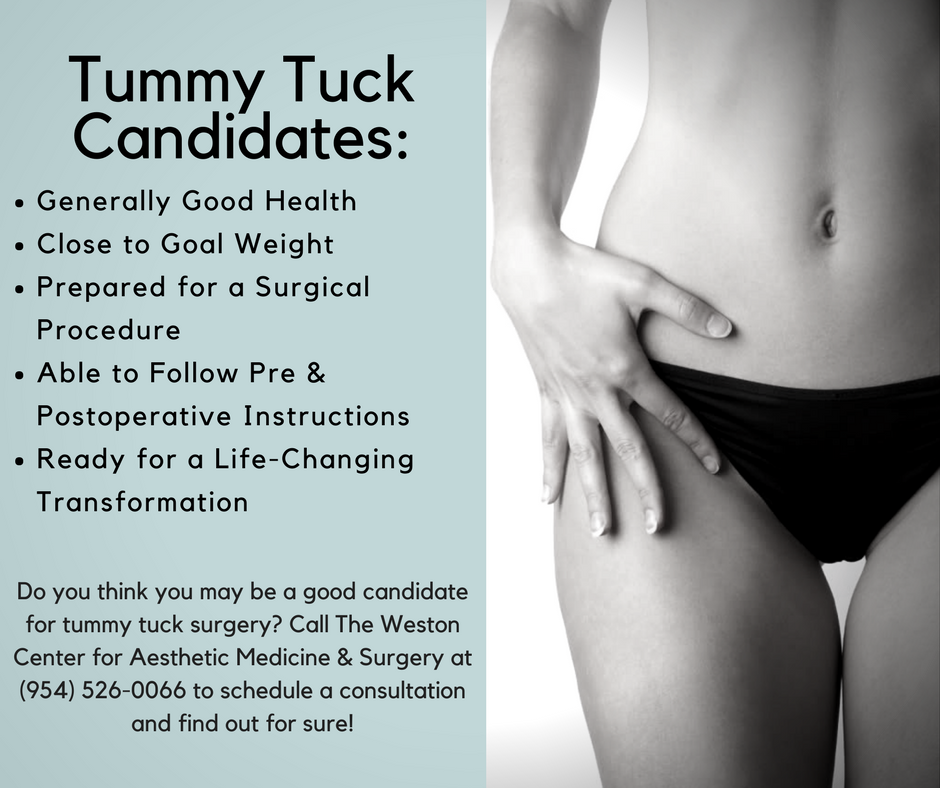 Miami Tummy Tuck Candidates | Ft. Lauderdale Abdominoplasty Candidates