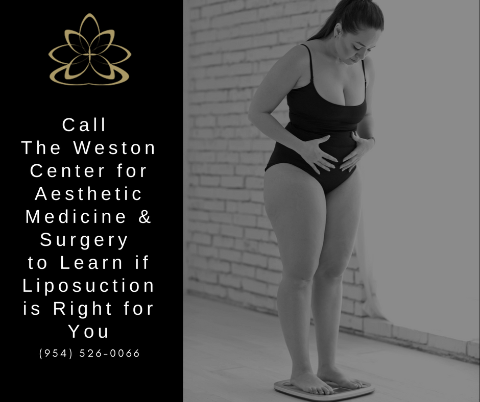 What can Lipo do | Weston | Miami | Ft. Lauderdale 