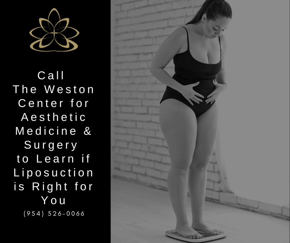 What can Lipo do | Weston | Miami | Ft. Lauderdale