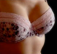 Davie Breast Surgery