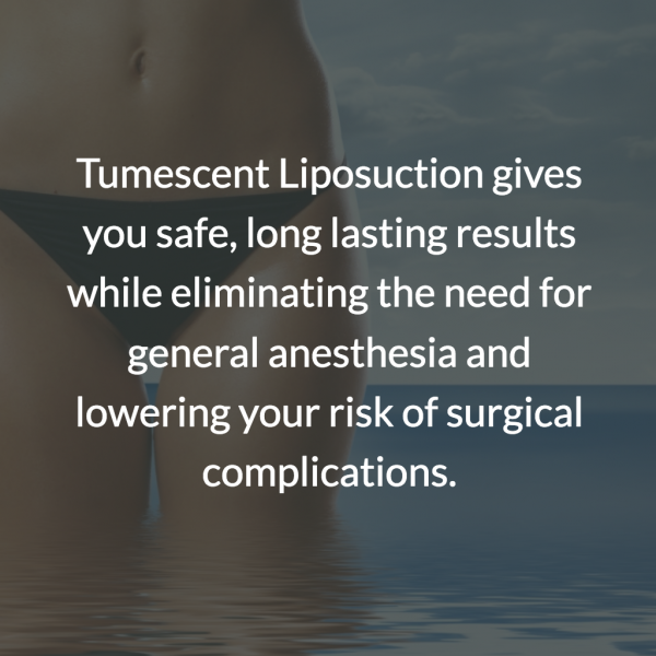 Liposukcja Tumescent nie wymaga znieczulenia ogólnego i wiąże się z mniejszym ryzykiem powikłań.