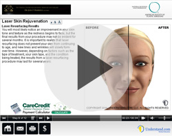 Video - Laser Skin Rejuvenation in Fort Lauderdale, Florida